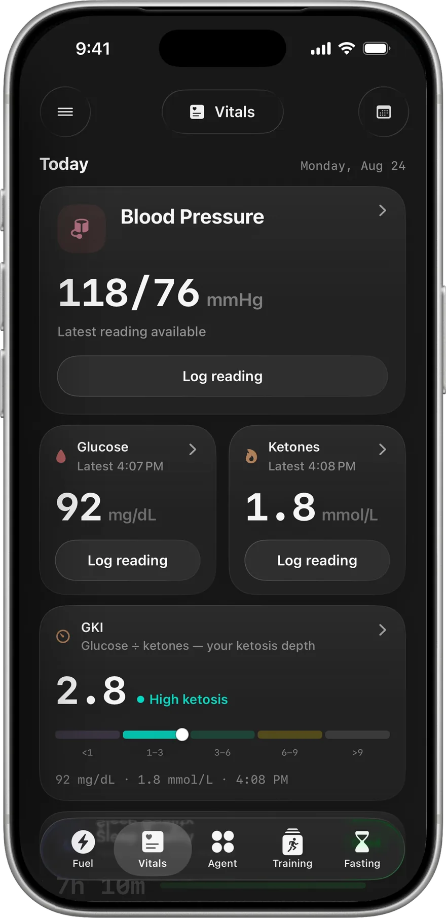 Vitals dashboard with blood pressure, glucose, ketones and the resulting GKI